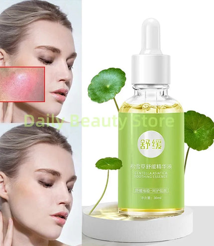 7 Day Repair Redness Serum Sooth Itching Sensitive Skin Improve