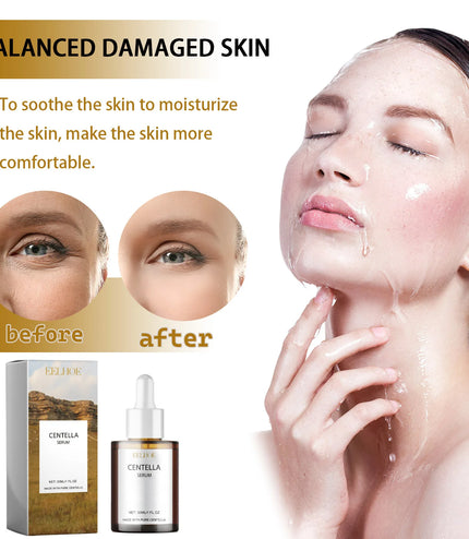 Korean Centella Asiatica Face Serum – Deep Nourishment &amp; Skin Smoothing