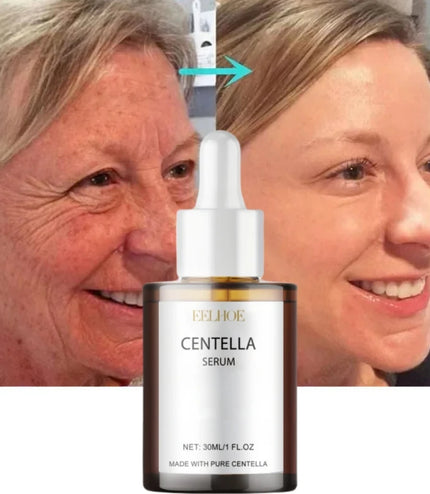 Korean Centella Face Serum Repair Facial Pore Smooth Rejuvenation Skin