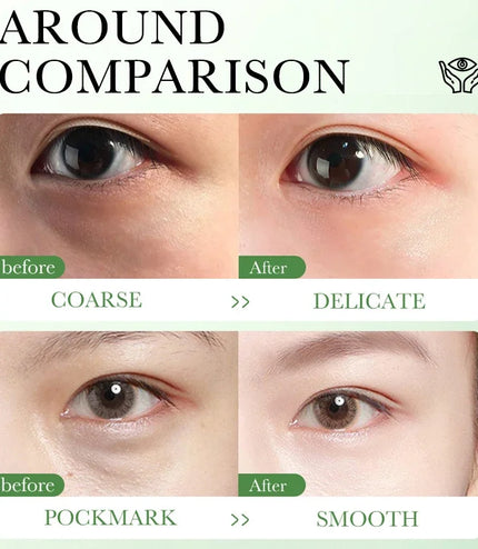 Centella Asiatica Eye Cream – Hydrating, Firming &amp; Brightening