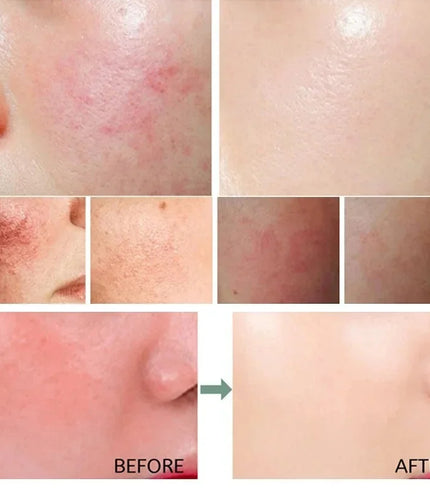 7 Day Repair Redness Serum Sooth Itching Sensitive Skin Improve
