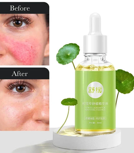 7 Day Repair Redness Serum Sooth Itching Sensitive Skin Improve