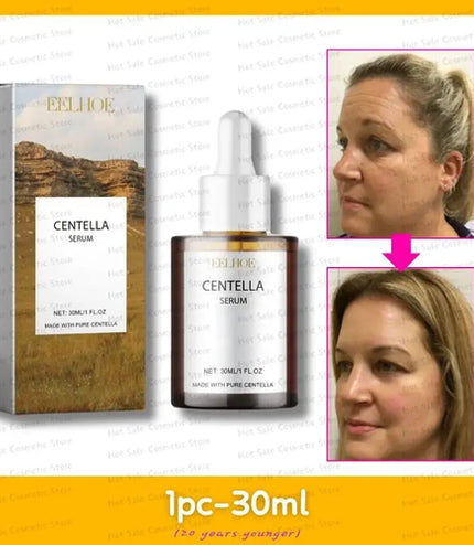 Korean Centella Asiatica Face Serum – Deep Nourishment &amp; Skin Smoothing