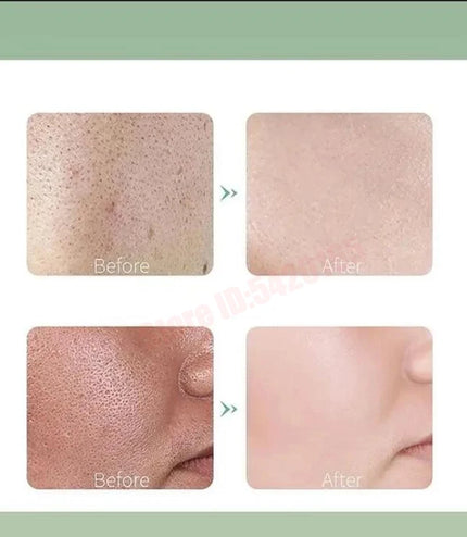 Deep Cleansing Bubble Mask – Hydrating &amp; Purifying Skincare