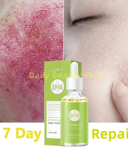 7 Day Repair Redness Serum Sooth Itching Sensitive Skin Improve