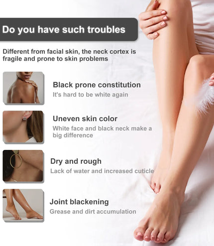 Body Whitening Bleach Cream – Brighten &amp; Even Out Skin Tone