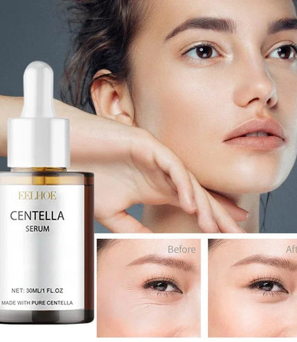 Reveal Your Natural Glow with Centella Asiatica Face Serum