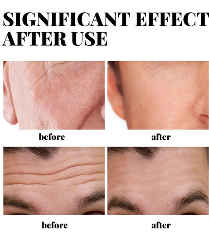 Men’s Collagen Face Cream – Anti-Wrinkle, Anti-Aging &amp; Deep Hydration